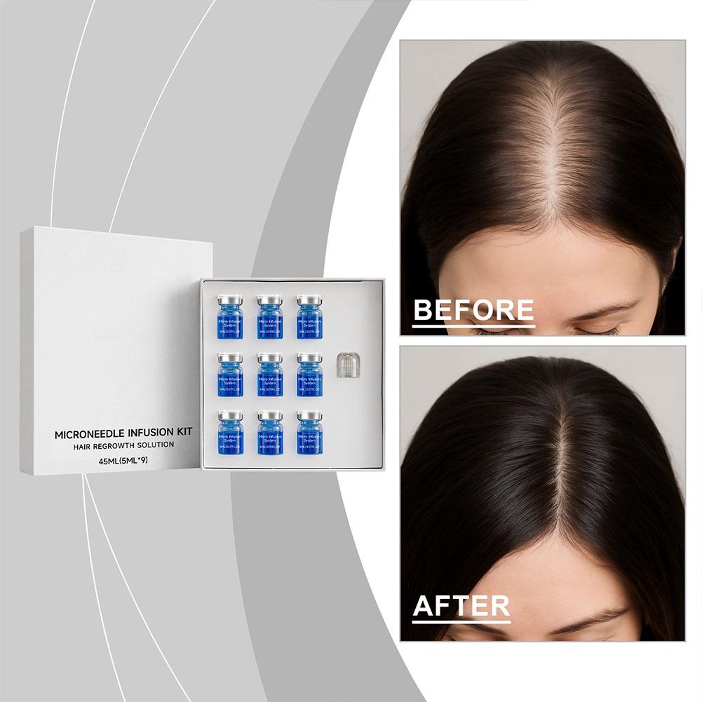 Derma Roller 0.25 - Sérum capillaire essentiel 0,25 mm avec