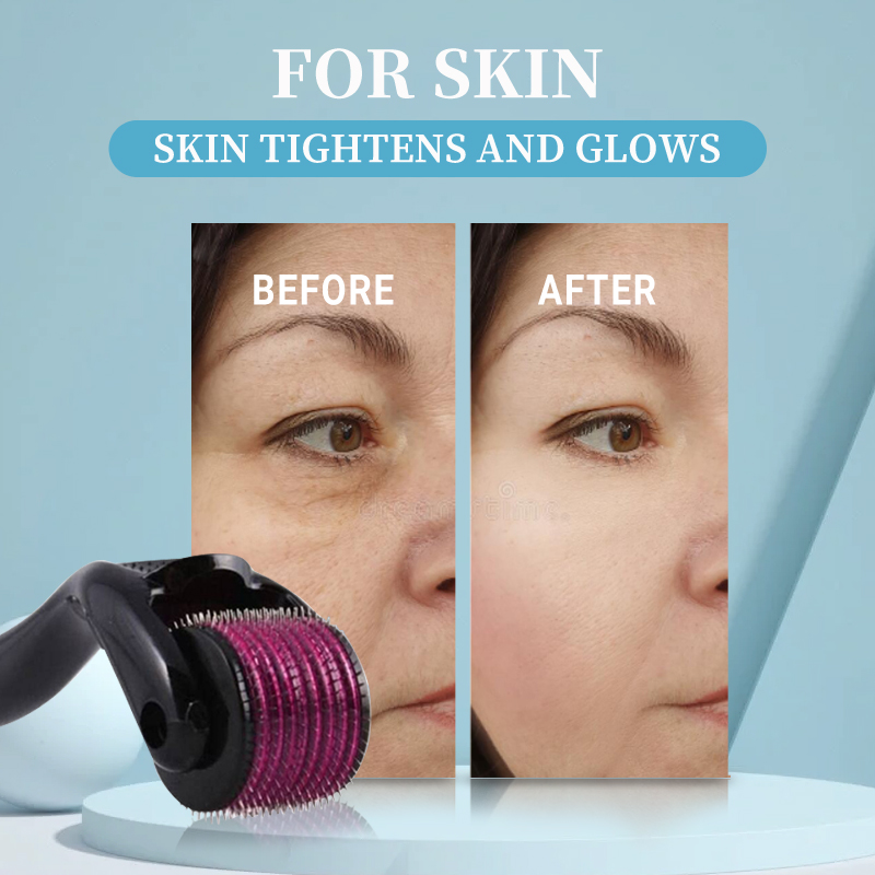 Professionnel 540 rouleau Derm - Derma Roller 0.25 avis et prix