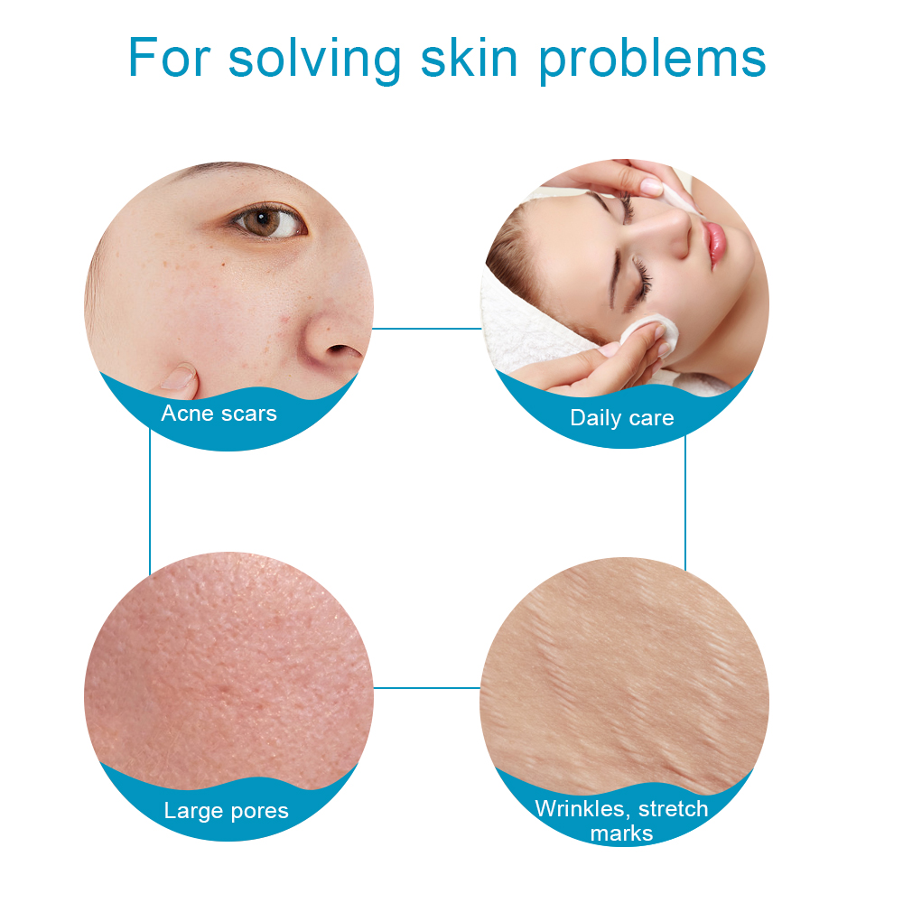 Rouleau Derma en titane 540, 1 - Derma Roller 0.25 avis et prix